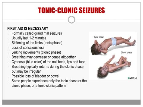 Ppt Seizures Epilepsy Powerpoint Presentation Free Download Id 1465533