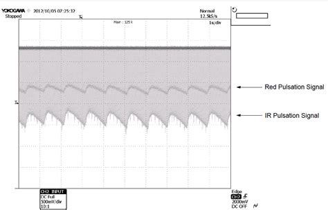Get the best deals on oximeters. Pulsoximeter mit wenigen Bauteilen entwickeln