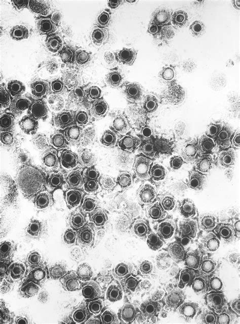 Electron Micrograph Of Coxsackie Virus Biology Of Humanworld Of Viruses