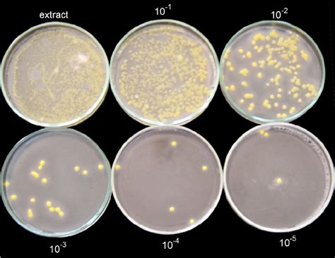 View Of Bacteria Colonies From Bean Variety Sremac On Xcp1 Medium