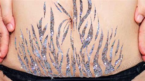 Learn To Love Your Stretch Marks—with Glitter