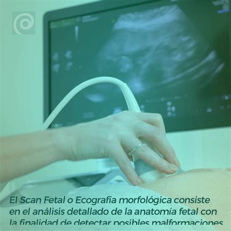 El Scan Fetal O Ecografía Morfológica Consiste En El Análisis Detallado