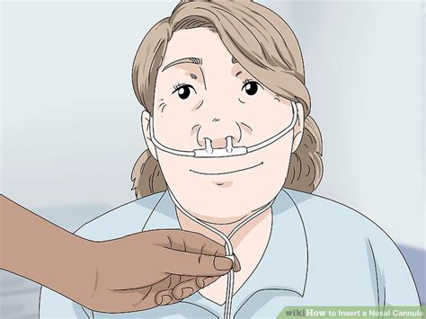 Some manufacturers recommend only using a clean, damp cloth to wipe down your nasal prongs some high flow nasal cannulas are even capable of providing up to 40 liters per minute. 3 Ways to Insert a Nasal Cannula - wikiHow