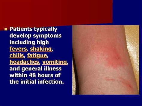 Acute Purulent Infections Of Soft Tissues A