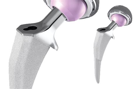 New Actis® Total Hip System From Depuy Synthes Idata Research