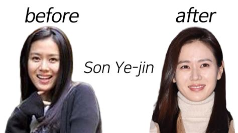 Son Ye Jin Before And After Youtube