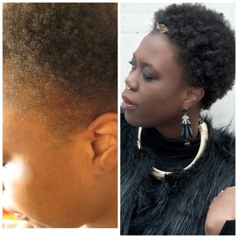 Receding Hairline Treatment How To Grow Back Your Edges Myfashions