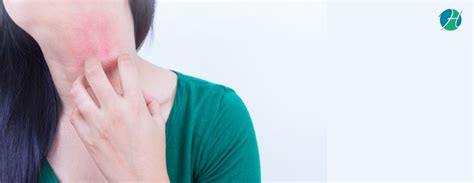 Eczema Symptoms Diagnosis And Treatment Healthsoul
