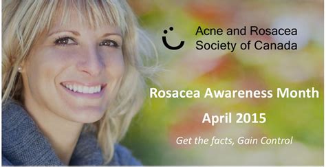 Rosacea Awareness Month April 2015 Acne And Rosacea Society