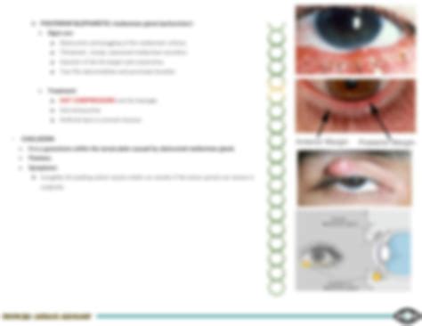 Solution Ophthalmology 10 Eyelid Diseases Studypool