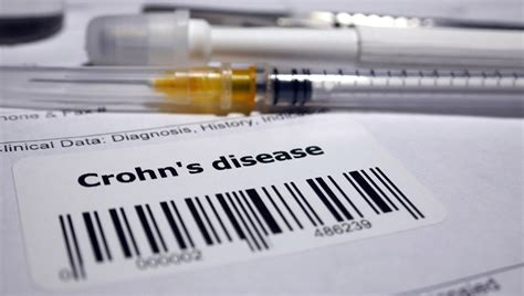Hiçbir zaman tam olarak iyileşmeyen sadece belirtilerin azaltılabildiği kalıcı bir hastalıktır. Crohn hastalığı nedir? (Crohn hastalığının belirtileri ve ...