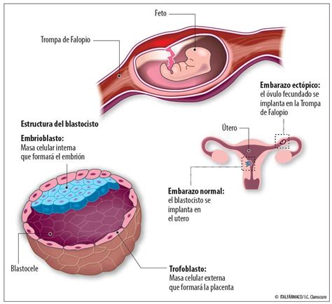 Implantación Clave Del Embarazo Espontáneo Y Por Fiv 2022