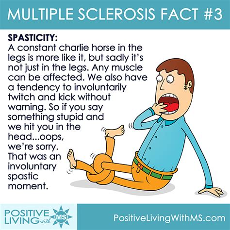 Multiple Sclerosis Spasticity | Multiple experienceS