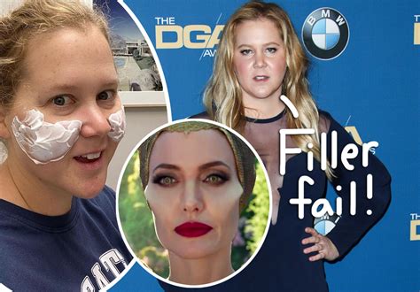 amy schumer got botched plastic surgery and immediately undid it i looked like maleficent