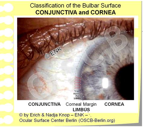 The Cornea — Ocular Surface Center Berlin