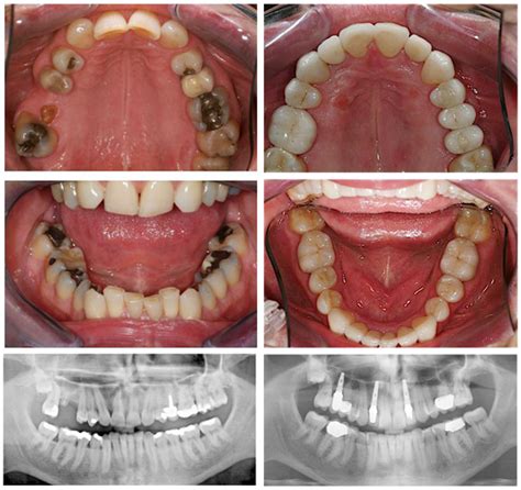 Orthodontic Dentistry Case Studies Advanced Dentistry