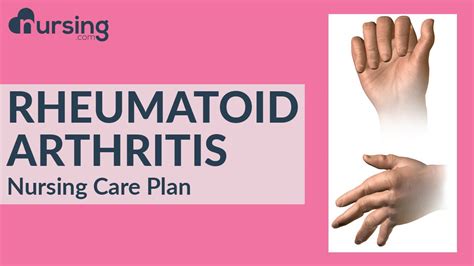 Nursing Care Plan For Rheumatoid Arthritis Nursing Care Plan Tutorial