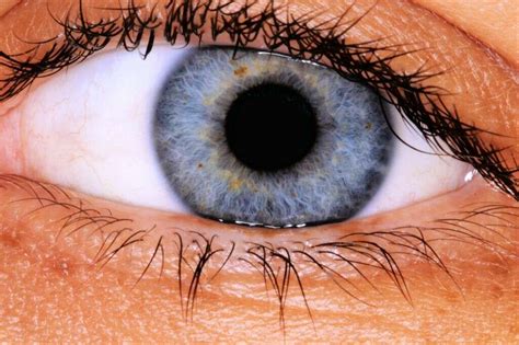 Retinal detachment describes an emergency situation in which a thin layer of tissue (the retina) at the back of the eye pulls away from its normal position. Detached Retina: 10 Detached Retina Symptoms
