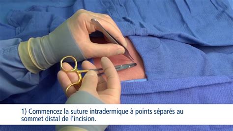 Vidéo de formation sur les techniques de points de sutures YouTube