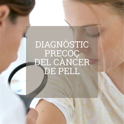 Diagnòstic Precoç I Tractament Del Càncer De Pell Epidermos Institut