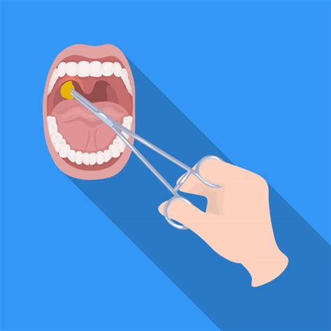 Tonsil Illustrations Royalty Free Vector Graphics And Clip Art Istock