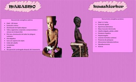 Resúmenes De Kwashiorkor Descarga Apuntes De Kwashiorkor