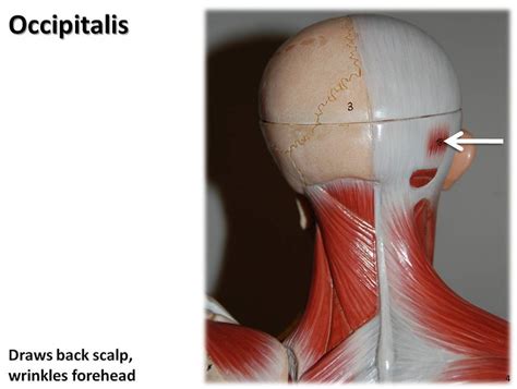 Occipitalis Muscles Of The Upper Extremity Visual Atlas Flickr