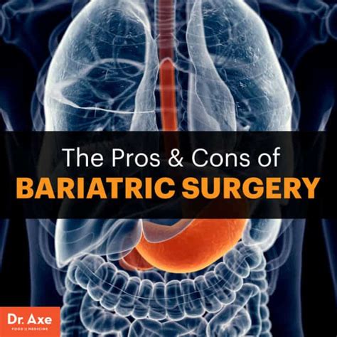 The Pros And Cons Of Bariatric Surgery Healthier Alternatives Dr Axe