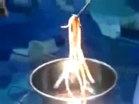 Imbasan menunjukkan cacing dalam perut seorang lelaki di india. Cacing pita di Perut Manusia pemakan daging Babi yang ...