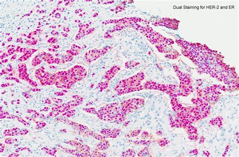 We have an established network of 37 electronically linked pathology facilities throughout peninsular malaysia, sabah and sarawak. Histology & Molecular Pathology Services | Pathology | UNM ...