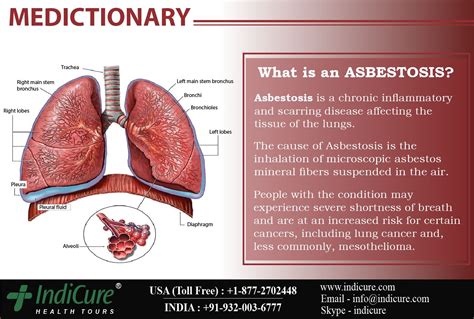 Maybe you would like to learn more about one of these? The human health effects from long-term unsafe asbestos ...