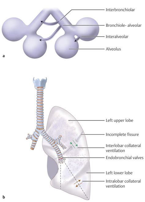 4 Lungs Radiology Key