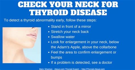 Check Your Neck For Thyroid Disease In 7 Easy Steps If A Problem Is