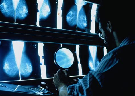 Opinion The New Mammogram Guidelines The New York Times