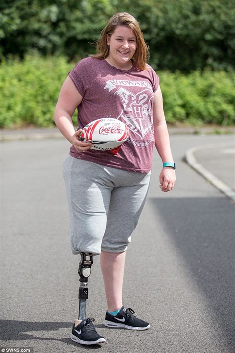 Rfu Charity Felt Bletchley Prop Gracie Matthews Losing A Leg Wasnt Serious Enough For Support
