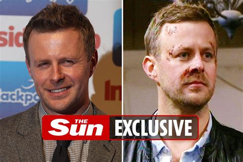Emmerdale Star Tom Lister Asked To Return As Carl Kings Ghost And Is