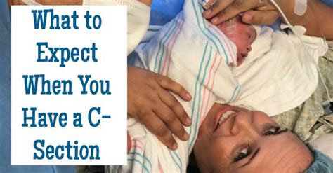The Epic List Of What To Expect When You Have A C Section