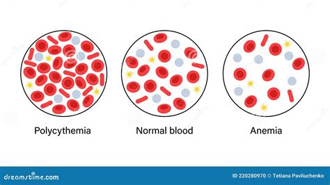 Blood Structure Concept Stock Vector Illustration Of Polycythemia