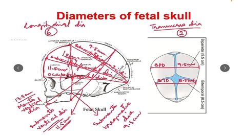 Fetal Skull Diameters Attitude Presenting Diameters Molding