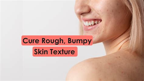 How To Improve Skin Texture Grainy Bumpy Rough Skin