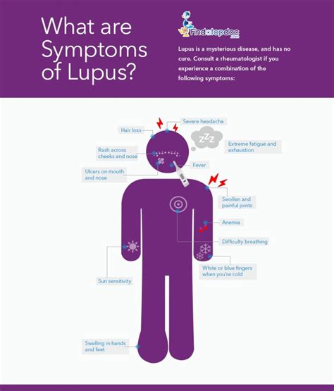 What Are The Symptoms Of Lupus Infographic Lupus Subacute