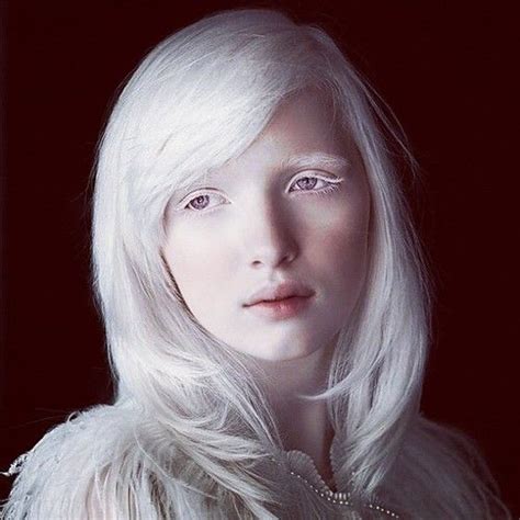 The Most Beautiful Albino Girl In The World Nastya Zhidkova Was Born