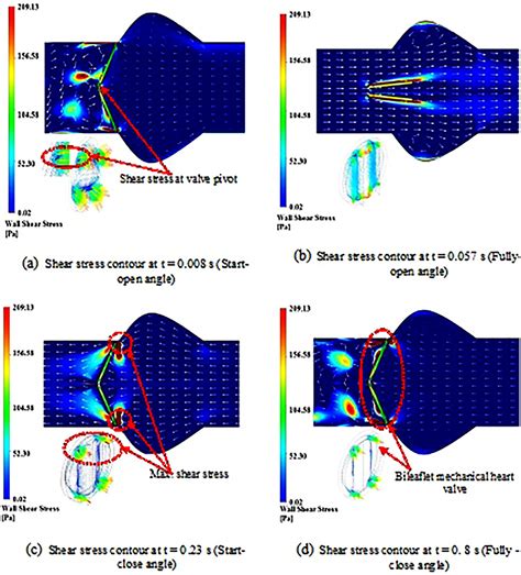Computational Fluid Dynamics Simulation Of Blood Flow Profile And Shear