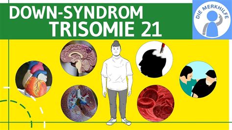 Down Syndrom Trisomie Definition Merkmale Ursachen Formen