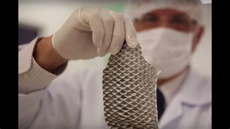Doctors Are Using Fish Skin To Treat Burn Victims Youtube
