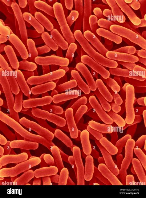 Coloured Scanning Electron Micrograph Sem Of Salmonella Enterica