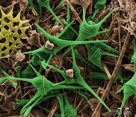 Ceratium furcoides is an invasive species that has caused ecological imbalance in several reservoirs in brazil. Ceratium algae from river water | Microscopic photography ...