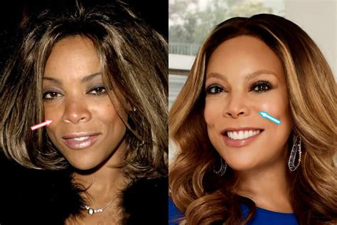 Wendy Williams Before Plastic Surgery Before And After Photosphotos
