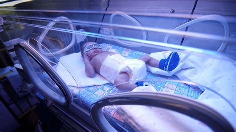 Nicu Hospitals In Bangalore Best Neonatology Doctor In Whitefield