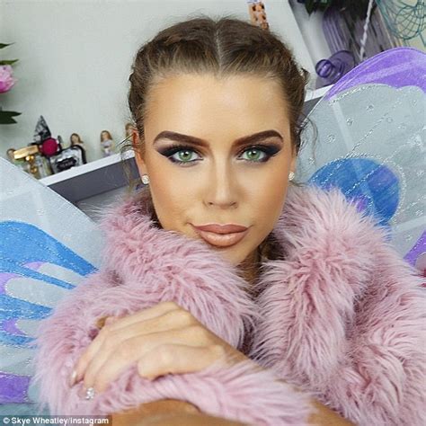 Skye Wheatley Is Unrecognisable After Lip Fillers And A Nose Job